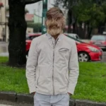 Ο πιο τριχωτός άνθρωπος στον κόσμο και το σπάνιο «σύνδρομο του λυκανθρώπου»