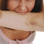 Γυναίκα δάγκωσε και έγδαρε τον σύντροφο της σε παραλία της Ρόδου