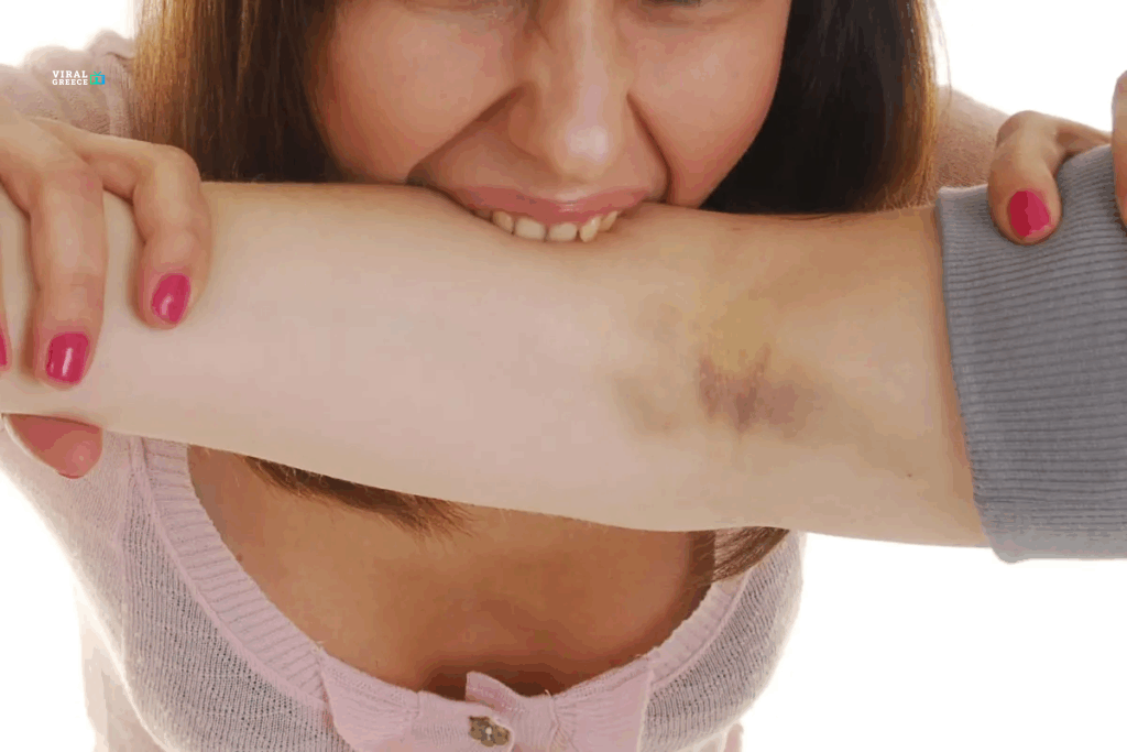 Γυναίκα δάγκωσε και έγδαρε τον σύντροφο της σε παραλία της Ρόδου dagkoma-1024x683