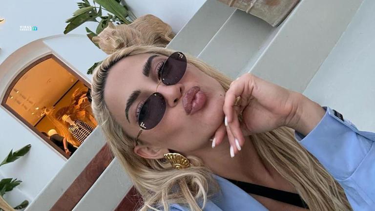 Μικρό ατύχημα στη Χαλκιδική για την Ιωάννα Τούνη – «Ίσως έχω κάταγμα», λέει η influencer