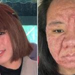 Γυναίκα αποκαλύπτει πώς η εγκυμοσύνη άλλαξε δραματικά το πρόσωπο της ( VIDEO ) Γυναίκα αποκαλύπτει πώς η εγκυμοσύνη άλλαξε δραματικά το πρόσωπο της ( VIDEO )