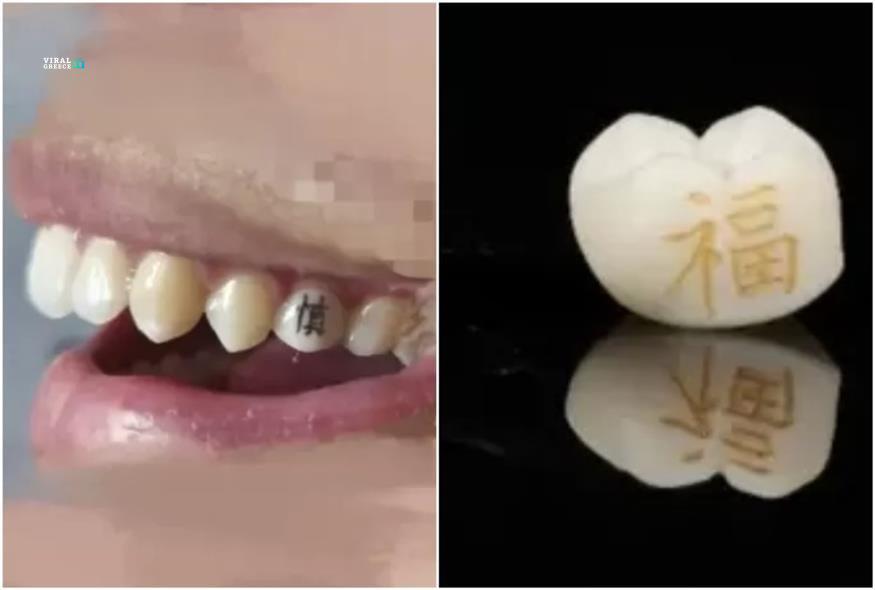 Το νέο… δαγκωτό trend στην Κίνα: Τα τατουάζ στα δόντια που «τρελαίνουν» τους νέους 875_8df5ba27-1ebe-46d5-9724-42eceec205f2