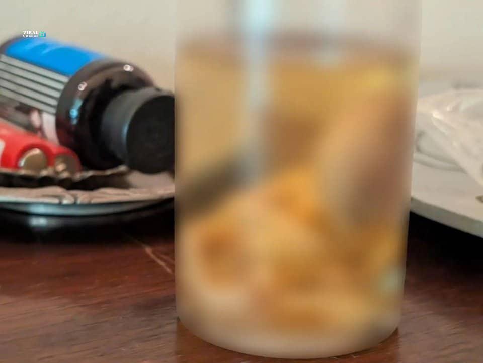 Σοκ στην Κρήτη: 77χρονος κατηγορούμενος για κατοχή ανθρώπινου εμβρύου σε φιάλη και αρχαίων αντικειμένων embryo-mpoukali1