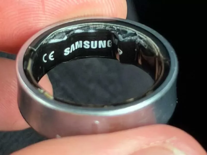 Χρήστης του Samsung Galaxy Ring κατέληξε στο νοσοκομείο λόγω διογκωμένης μπαταρίας 5 galaxy rign swollen battery.jpg 1