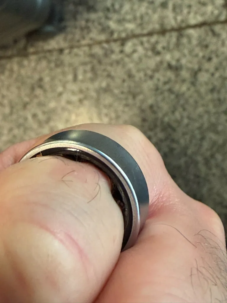 Χρήστης του Samsung Galaxy Ring κατέληξε στο νοσοκομείο λόγω διογκωμένης μπαταρίας 4 galaxy ring swollen battery 1.jpg