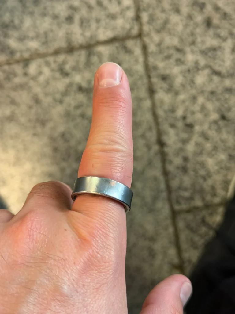 Χρήστης του Samsung Galaxy Ring κατέληξε στο νοσοκομείο λόγω διογκωμένης μπαταρίας 3 galaxy ring swollen battery 2.jpg