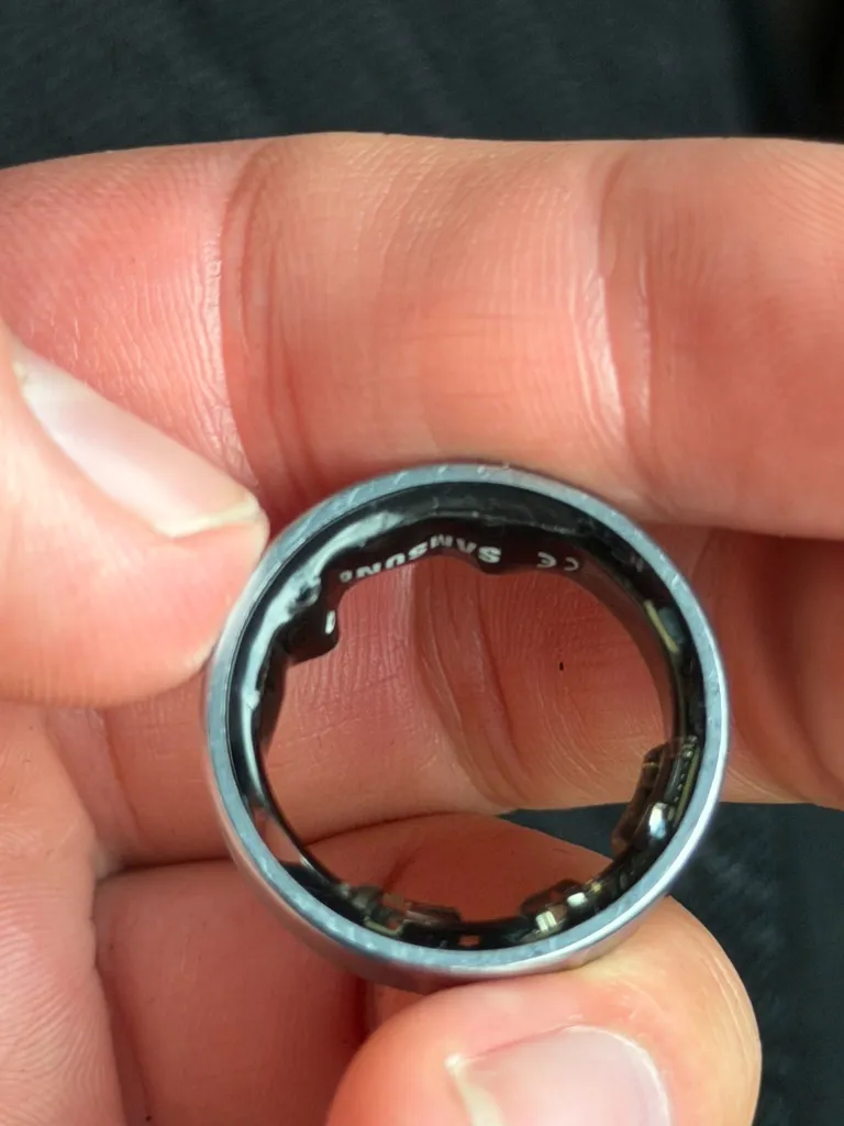 Χρήστης του Samsung Galaxy Ring κατέληξε στο νοσοκομείο λόγω διογκωμένης μπαταρίας 2 galaxy ring swollen battery 4.jpg
