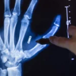 Ξέχασε… τον κωδικό του εμφυτευμένου τσιπ: Μάγος–βιολόγος από το Μιζούρι «κλειδώθηκε» έξω από το ίδιο του το σώμα Ξέχασε… τον κωδικό του εμφυτευμένου τσιπ: Μάγος–βιολόγος από το Μιζούρι «κλειδώθηκε» έξω από το ίδιο του το σώμα