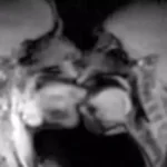 Έκαναν σεξ μέσα σε μαγνητικό τομογράφο – Τι αποκάλυψαν οι εικόνες του MRI