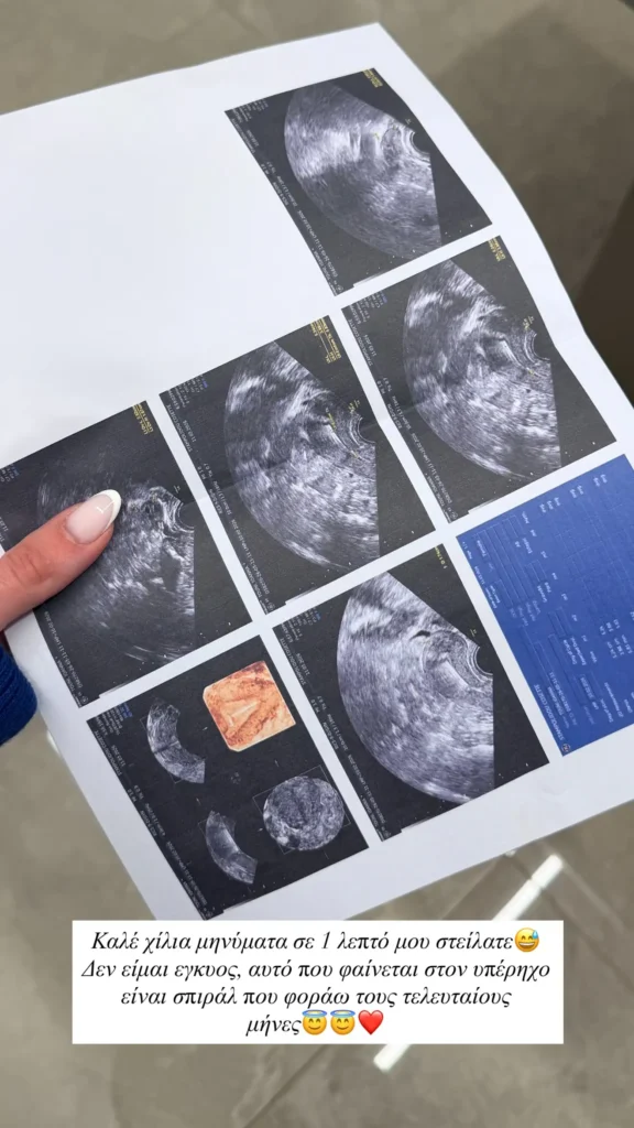 ioanna touni gynaikologos test pap 1