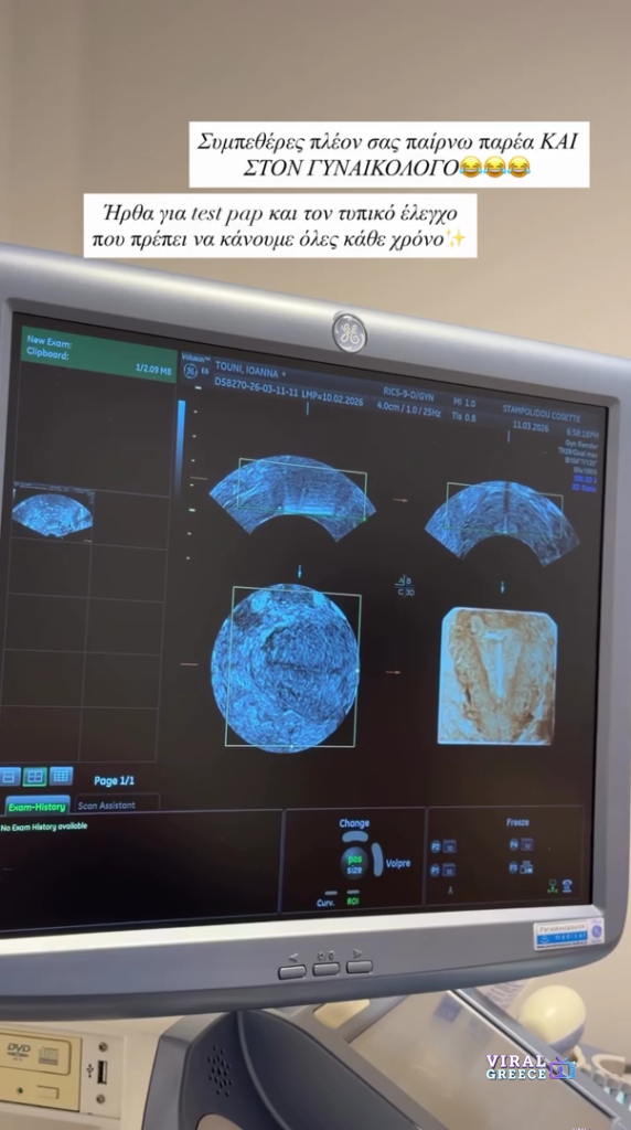 Ιωάννα Τούνη: Η ανάρτηση από τον γυναικολογικό έλεγχο που μπέρδεψε τους followers ioanna touni gynaikologos test pap