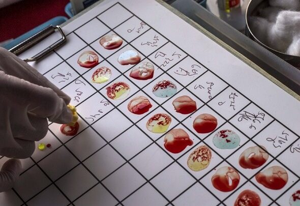 w02-105556bloodtest800454