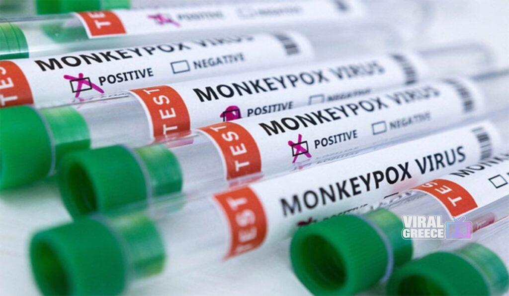 Συναγερμός στα Ιωάννινα: Πρώτο κρούσμα mpox στην Ελλάδα για το 2026