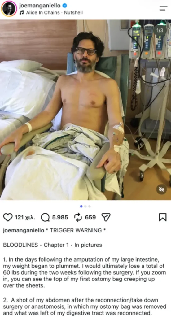 Τζο Μανγκανιέλο: Η δύσκολη μάχη και τα 27 κιλά joe