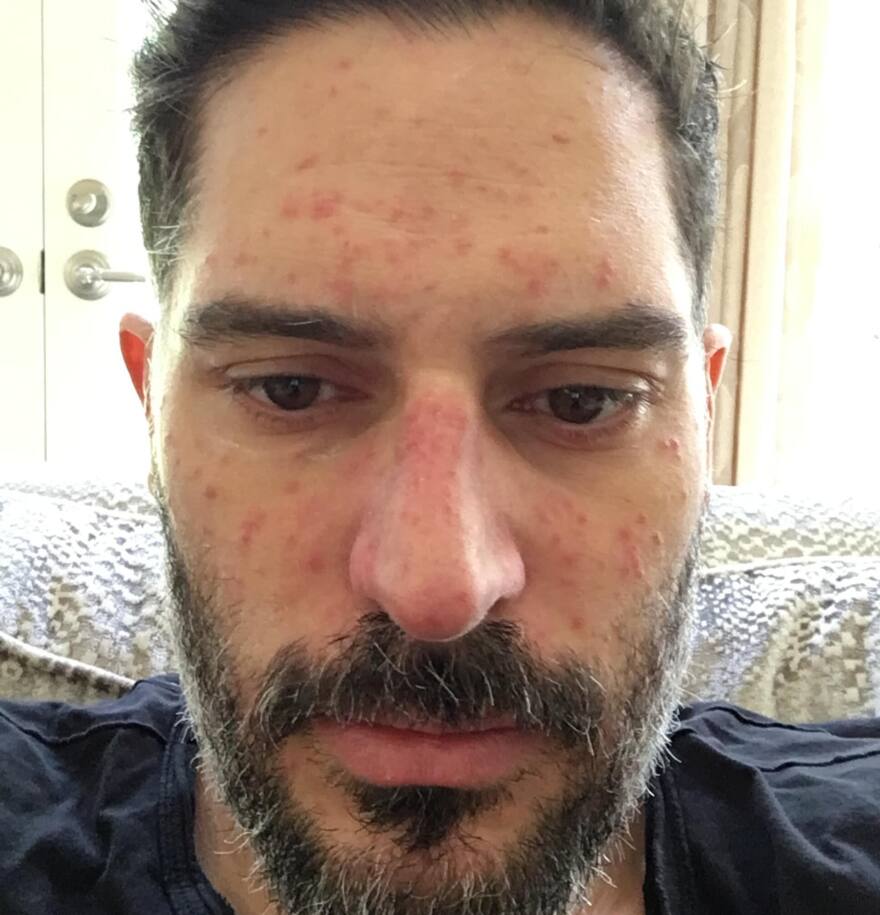 Τζο Μανγκανιέλο: Η δύσκολη μάχη και τα 27 κιλά snapinsta to 851503267 18638167036030465 3302238035254987307 n